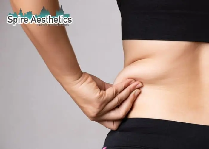 Image of woman pinching fat on their hips St George. Fat Freezing treatment